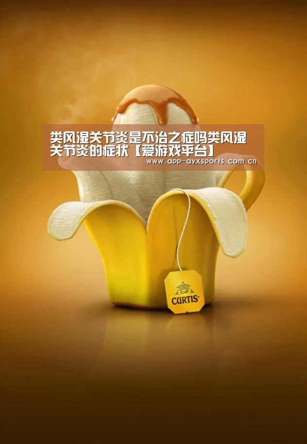 体育赛事直播